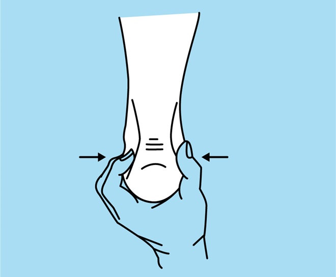 maladie de sever - test de compression pour le diagnostic